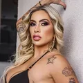 Silicone industrial: veja como está bumbum de Juju Ferrari após infecção imagem