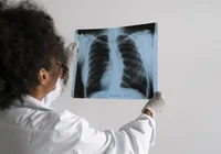 Agosto Branco alerta para prevenção ao câncer de pulmão imagem