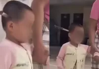 Criança é atingida com facada na cabeça após surto de mãe