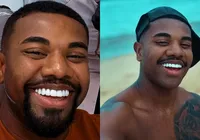 Davi Brito cede a críticas e troca lente de contato dos dentes imagem