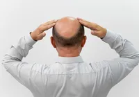 É dos carecas que elas gostam mesmo? Pesquisa responde imagem
