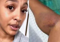 Ela está bem? Sheron Menezzes revela acidente impressionante imagem
