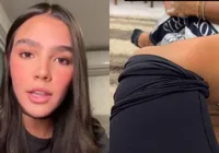 Ex-nora de Huck e Angélica recusa cirurgia para tumor: "Cicatriz fica muito feia"