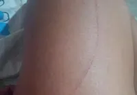 Garota de programa é vítima de estupro e pula de carro para fugir imagem