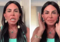 Gretchen mostra rosto pela primeira vez após nova harmonização facial