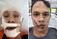 Homem que agrediu personal trainer com copo de vidro é identificado imagem