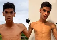 Internado, Luva de Pedreiro tem diagnóstico confirmado
