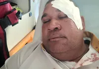 Motorista de ônibus é agredido com marteladas na cabeça em Salvador