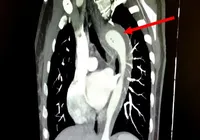 Mulher rompe a aorta durante o sexo e é internada com risco de morte imagem