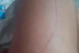 Garota de programa é vítima de estupro e pula de carro para fugir - Imagem