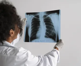Agosto Branco alerta para prevenção ao câncer de pulmão