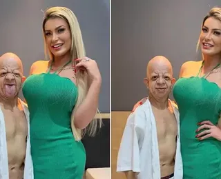 Andressa Urach grava vídeo +18 ao lado influenciador com doença rara