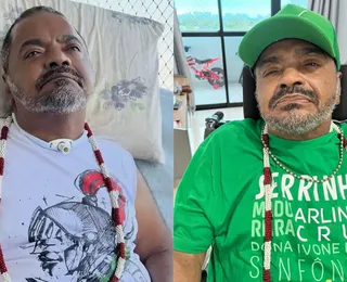 Arlindo Cruz morreu? Entenda notícia que assustou a web