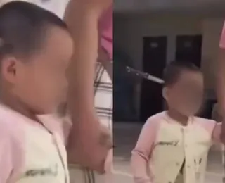 Criança é atingida com facada na cabeça após surto de mãe