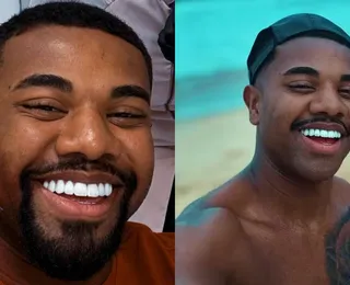 Davi Brito cede a críticas e troca lente de contato dos dentes