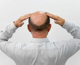 É dos carecas que elas gostam mesmo? Pesquisa responde