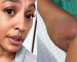 Ela está bem? Sheron Menezzes revela acidente impressionante