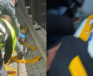 Funkeiro famoso sofre acidente de moto e perfura pulmão