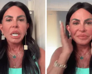 Gretchen mostra rosto pela primeira vez após nova harmonização facial