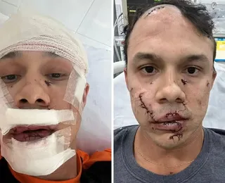 Homem que agrediu personal trainer com copo de vidro é identificado