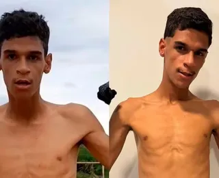 Internado, Luva de Pedreiro tem diagnóstico confirmado