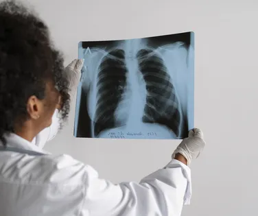 Agosto Branco alerta para prevenção ao câncer de pulmão - Imagem