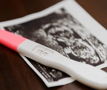 Gravidez silenciosa: por que algumas mulheres só descobrem a gestação - Imagem