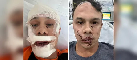 Homem que agrediu personal trainer com copo de vidro é identificado - Imagem