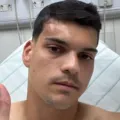 Após levar pancada na cabeça, Brazão, do Santos posta foto: "Susto" imagem