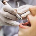 Dentista é indiciada por lesões graves e exercício ilegal da medicina imagem
