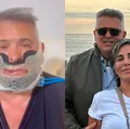 É grave? Marido de Gloria Pires passa por cirurgia complicada imagem