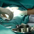 Fimose e HIV: ciência revela como a circuncisão pode reduzir riscos de contaminação imagem