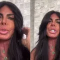 Gretchen revela uso de maconha para tratar doença séria: “Liberdade” imagem