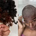Influenciador baiano raspa a cabeça após descobrir doença imagem