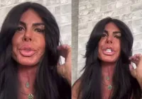 Gretchen revela uso de maconha para tratar doença séria: “Liberdade” imagem