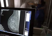 SUS amplia mamografia para mulheres a partir dos 40 anos