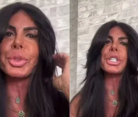 Gretchen revela uso de maconha para tratar doença séria: “Liberdade” - Imagem