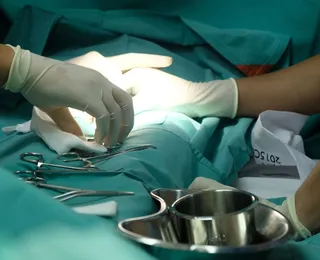 Fimose e HIV: ciência revela como a circuncisão pode reduzir riscos de contaminação