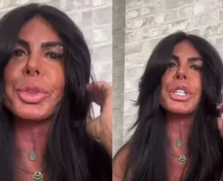 Gretchen revela uso de maconha para tratar doença séria: “Liberdade”