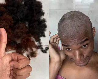 Influenciador baiano raspa a cabeça após descobrir doença