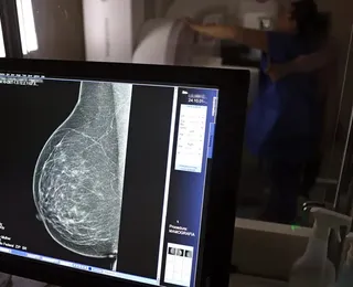 SUS amplia mamografia para mulheres a partir dos 40 anos