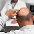 Adoçante pode ajudar a melhorar calvície de homens imagem