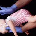 Desengasgo tem novas regras para bebês e adultos; veja o que mudou imagem