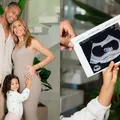 Grávida, Lore Improta exibe ultrassom e web aponta sexo do bebê imagem