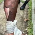 Homem é preso após atear fogo na esposa no interior da Bahia imagem