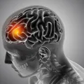 Influenciadora famosa revela aneurisma cerebral: “Semana difícil” imagem