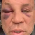 Wanderlei Silva relata dores na cabeça e desabafa após briga com Popó imagem