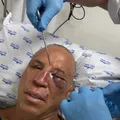 Wanderlei processará agressor por tentativa de homicídio, diz advogado imagem