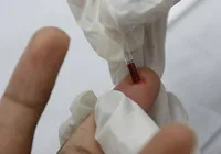 Cientistas descobrem anticorpo supereficaz contra o HIV imagem