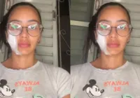 Ex-bailarina do Faustão é esfaqueada pela mãe e pede ajuda na web